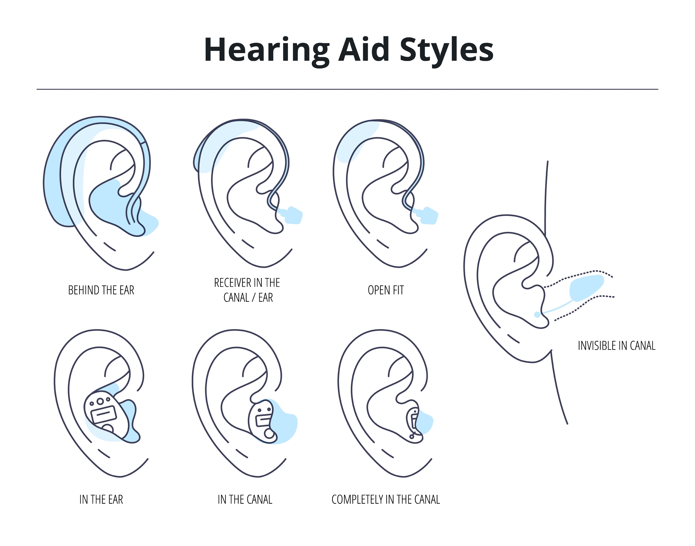 Miracle Ear Review More Than Just A Hearing Aid 3643